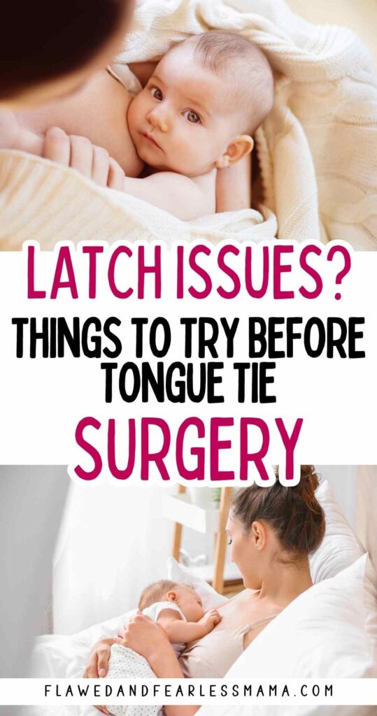 A mom breastfeeding her baby with the words "latch issues? things to try before tongue tie surgery"